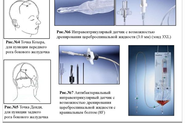 Онион сайты список 2023